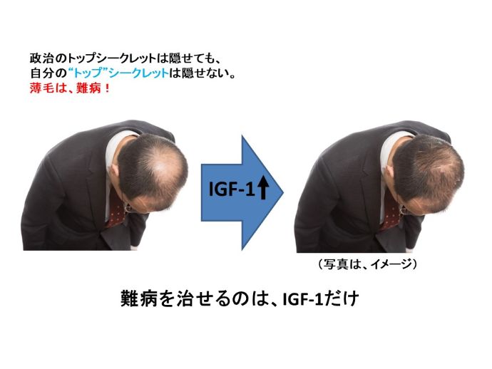 円形脱毛症　病院